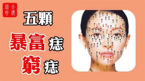 背有痣:辛苦命|身上若有8顆「辛苦痣」 一生勞碌奔波、難以安樂